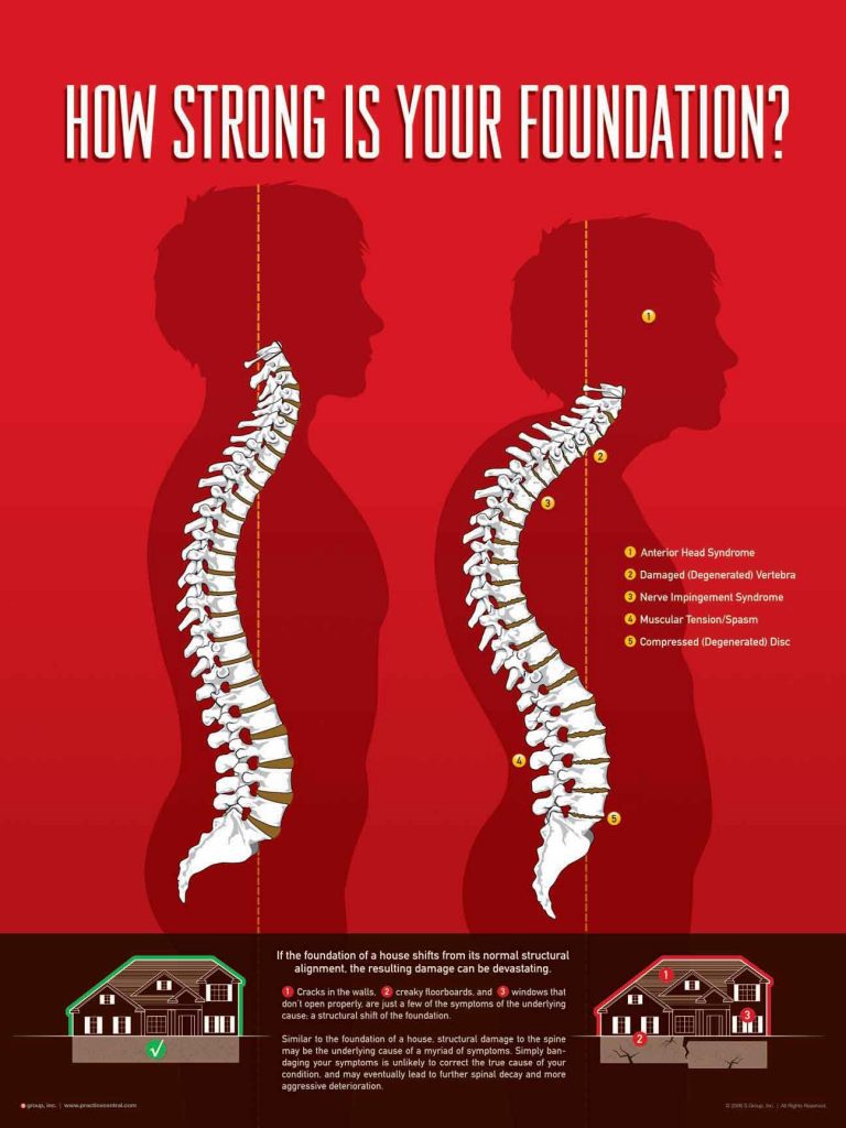 Just What Is Happening When A Chiropractor Cracks' Your Back? — Garden  State Spinal Care